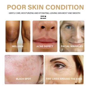 EELHOE Turmeric Dark Spot Correcting Serum Face Care Spot Moisturizing Nourishing Repairing Complexion Serum - Image 6